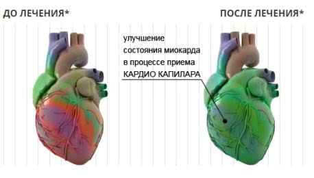Кардио Капилар
